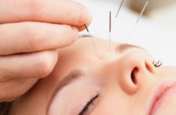 acupuncture in ocean county, nj