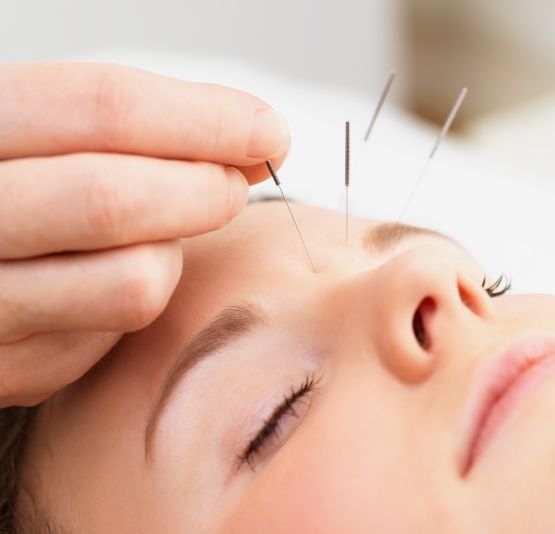 Healthcare Medicine Institute reinforces known benefit of acupuncture - headache pain relief