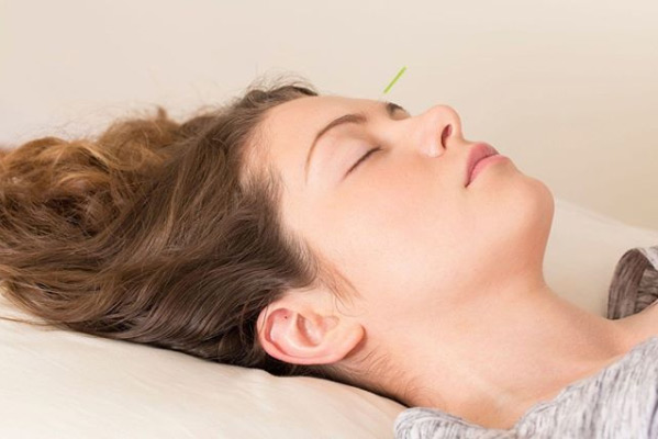 Anxiety Treatment with Acupuncture